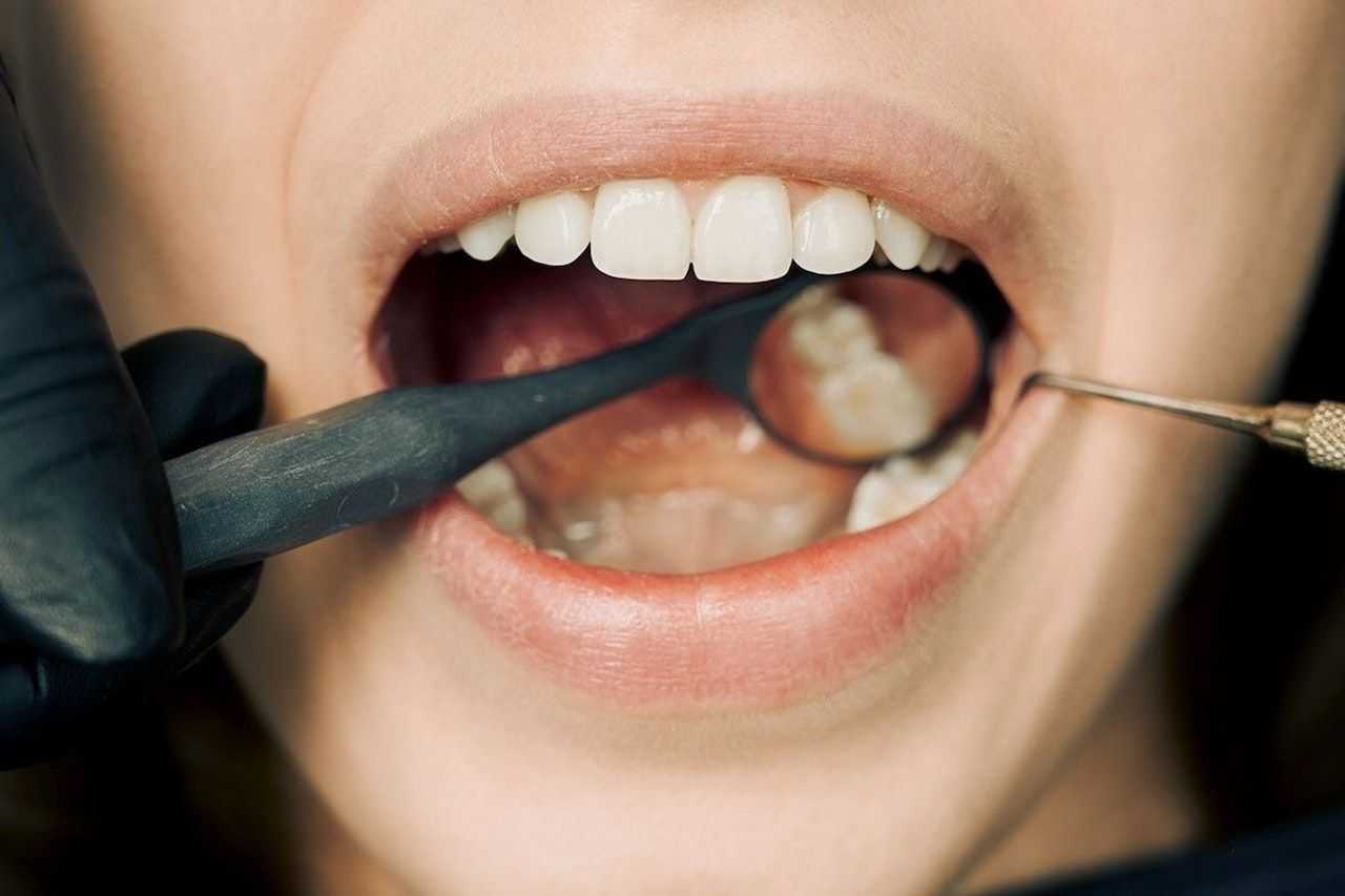 Periodontal Disease: Causes, Symptoms, and Treatment Options